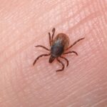 Limeira (SP) confirma quarta morte por febre maculosa no município este ano