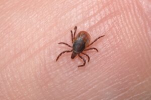 febre maculosa