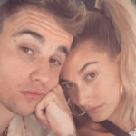 Justin Bieber e Hailey querem processar cirurgião que indicou plásticas da modelo