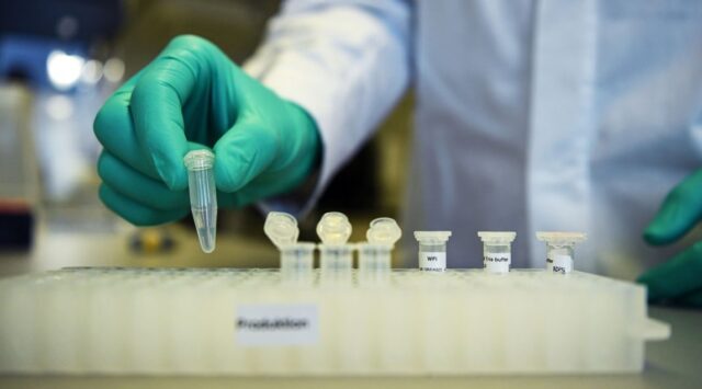 foto de exames coronavírus