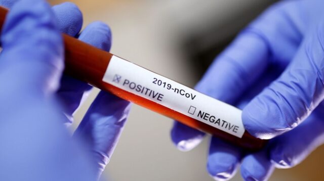 Uma foto de um teste positivo para Covid-19