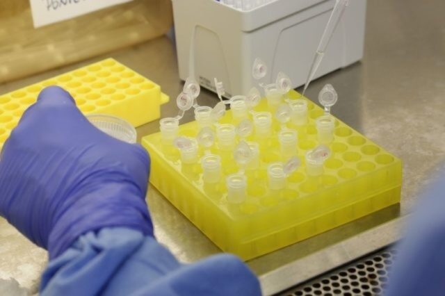 uma foto com vários tubos de exames para testes de reinfecção uma foto com vários tubos de exames para testes de reinfecção