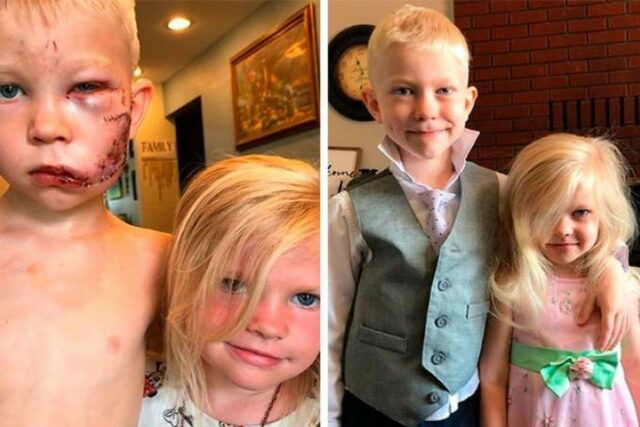 Uma foto de Bridger com a irmã que ele salvou do ataque do cachorro