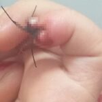 Bebê perde a ponta do dedo durante atividades no parquinho em creche de Piracicaba
