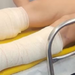 Indivíduo quebra as duas pernas da ex-companheira durante discussão em Piracicaba