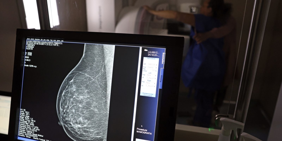 Câncer de mama: saiba como acessar auxílio-doença e outros benefícios