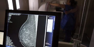 Câncer de mama: saiba como acessar auxílio-doença e outros benefícios
