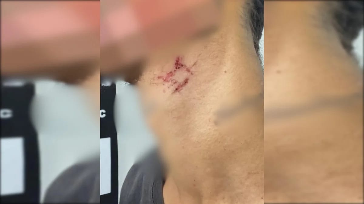 Jovem de 22 anos é resgatado de cárcere privado após mais de um ano sendo mantido como escravo sexual