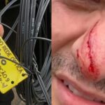 Motociclista tem o rosto ferido após se enroscar em cabos de telefonia em Piracicaba