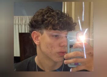 Jovem de 17 anos morto em acidente entre carro e moto na Rodovia Geraldo de Barros é identificado