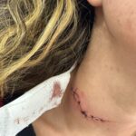 Indivíduo é preso após mulher dar entrada em UPA com corte no pescoço em Piracicaba