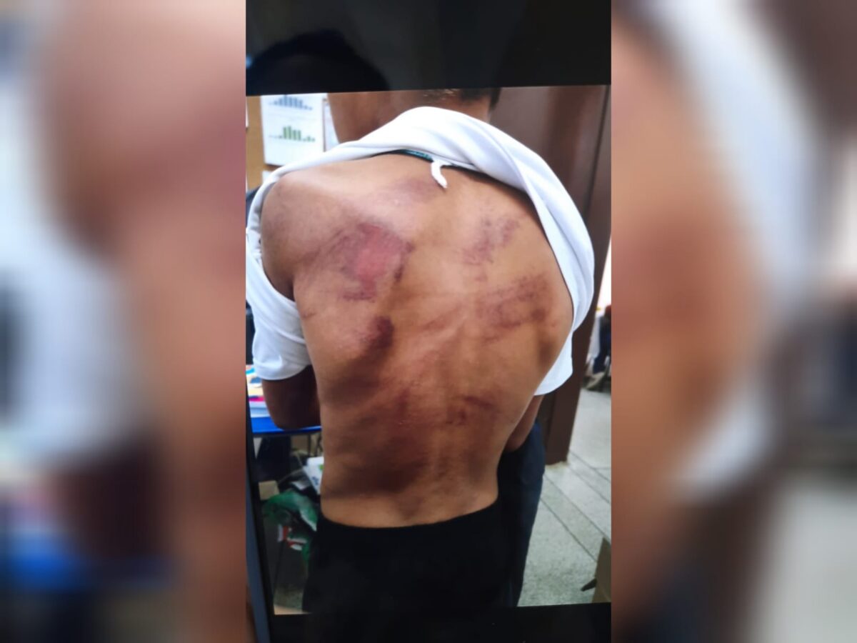Pai é preso após espancar o filho de nove anos na região de Piracicaba