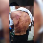 Pai é preso após espancar o filho de nove anos na região de Piracicaba