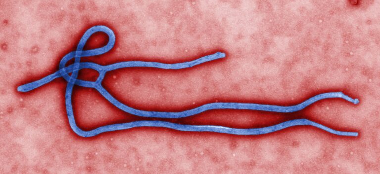 Vírus Ebola visto em microscópio