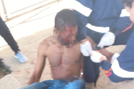 Homem é socorrido em estado grave após ser esfaqueado ao lado do Estádio do XV de Piracicaba