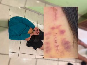 Jovem de 23 anos é encontrada ferida após ser mantida em cárcere privado pelo companheiro em Piracicaba