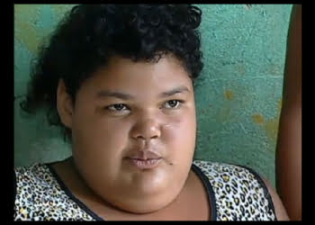 Justiça obriga família a tratar filha obesa, que tem 11 anos e pesa mais de 150 kg