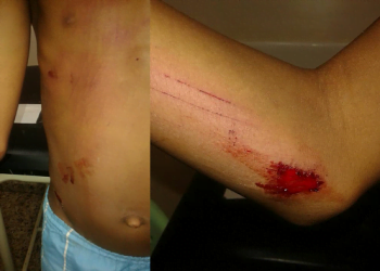 Mulher bate em criança com pedra após brigar com o namorado