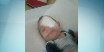 Bebê com cegueira passa por cirurgia paga com doações em Limeira