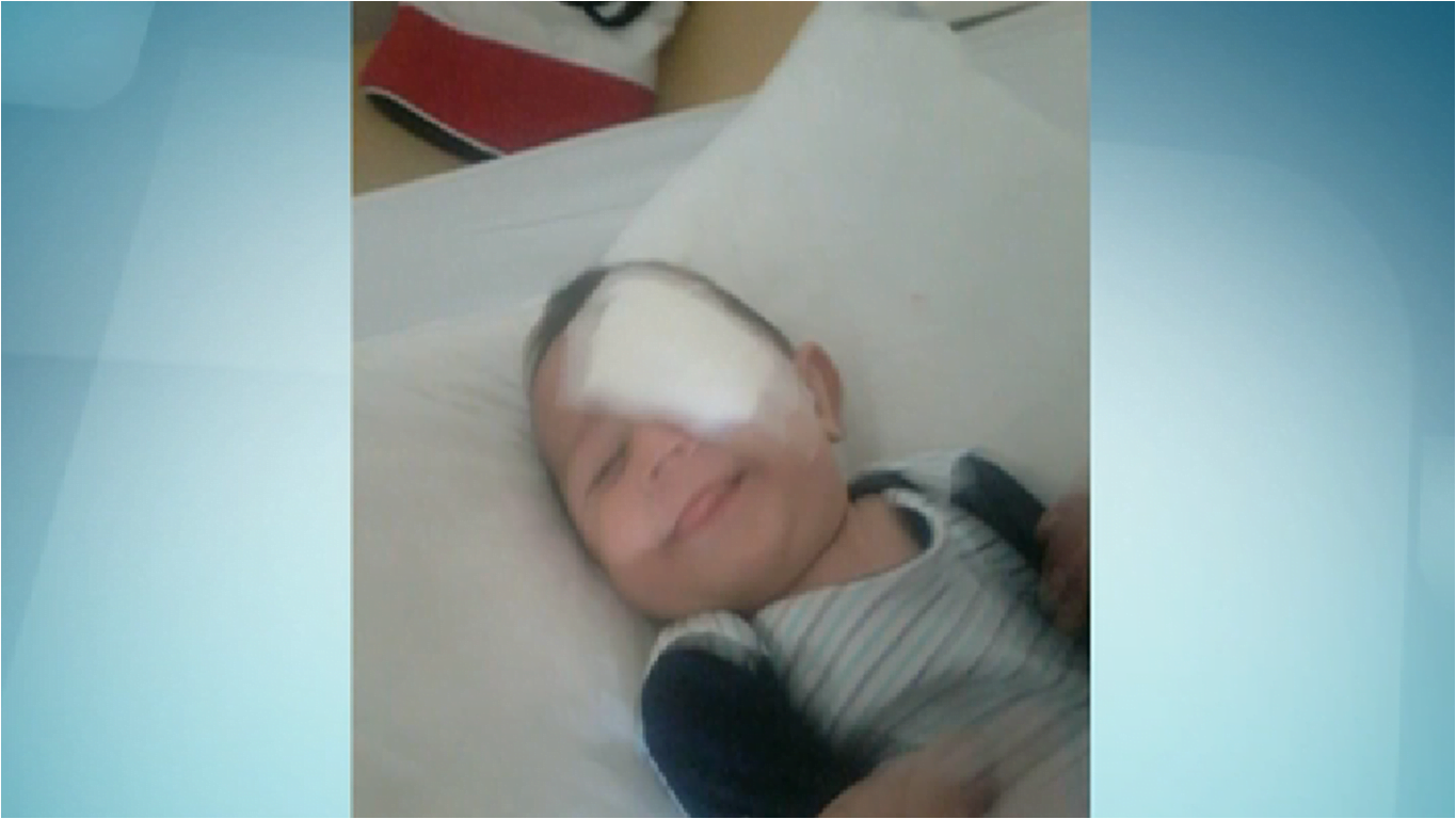 Bebê com cegueira passa por cirurgia paga com doações em Limeira