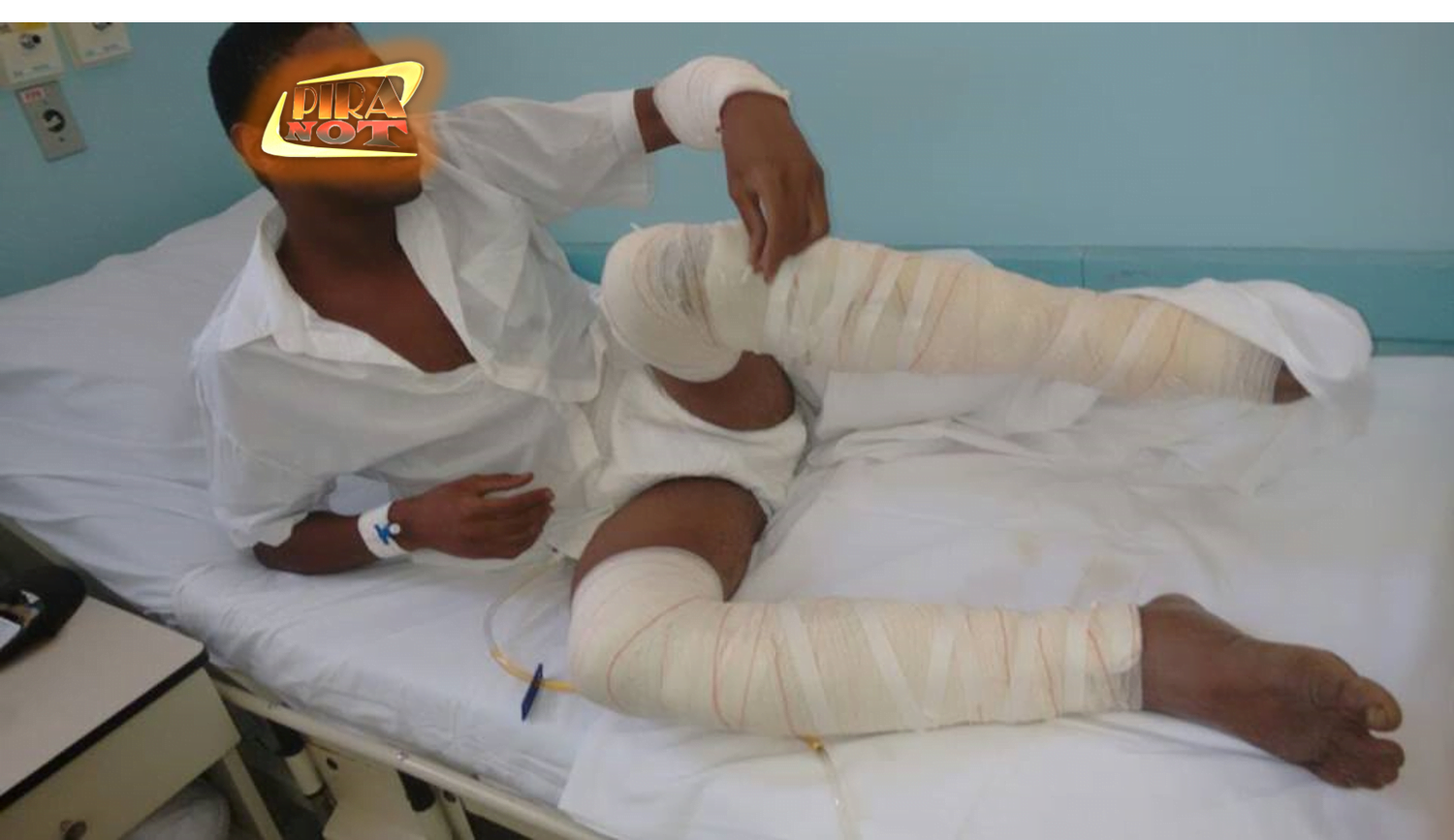 Queimado, polícia prende homem que incendiou ônibus no Jaraguá