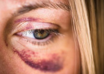 Mulher grávida nega beijo e acaba agredida por homem